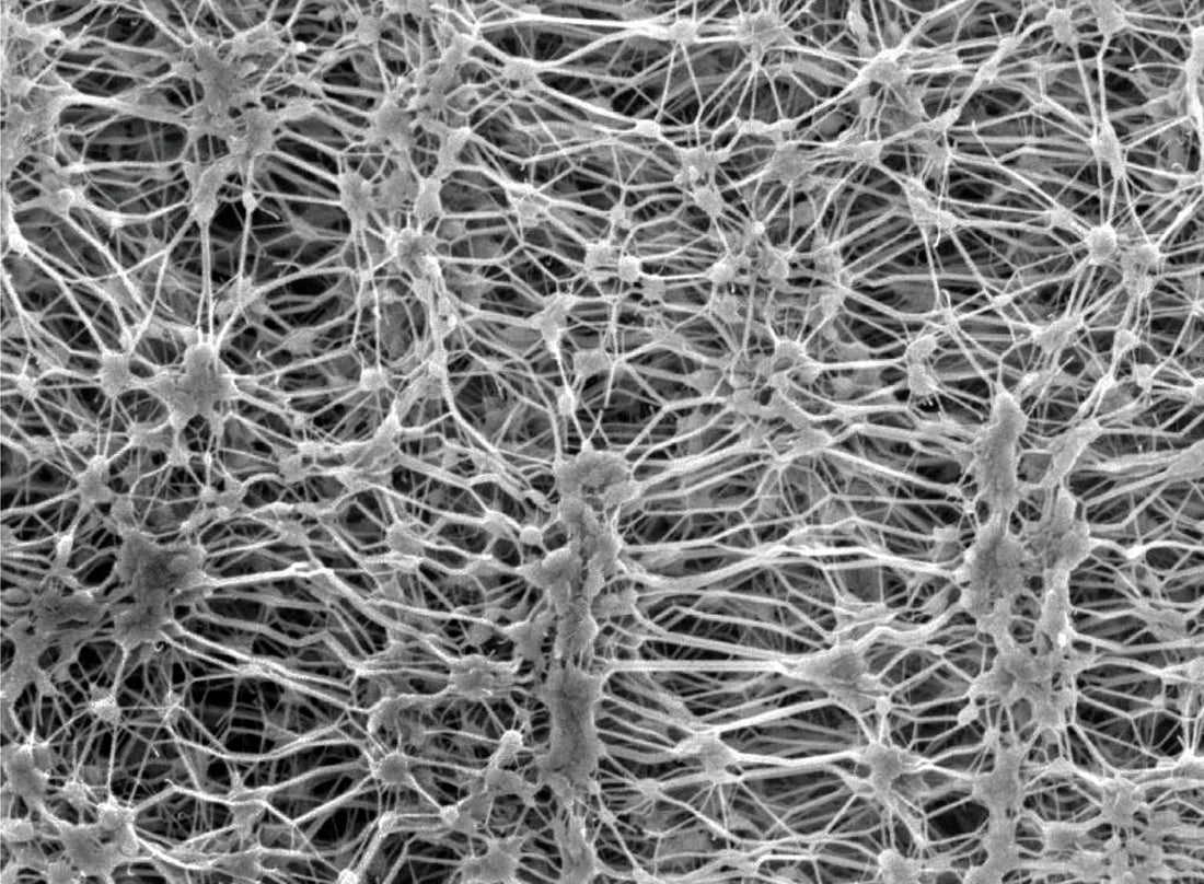 Its not magic, just membranes!